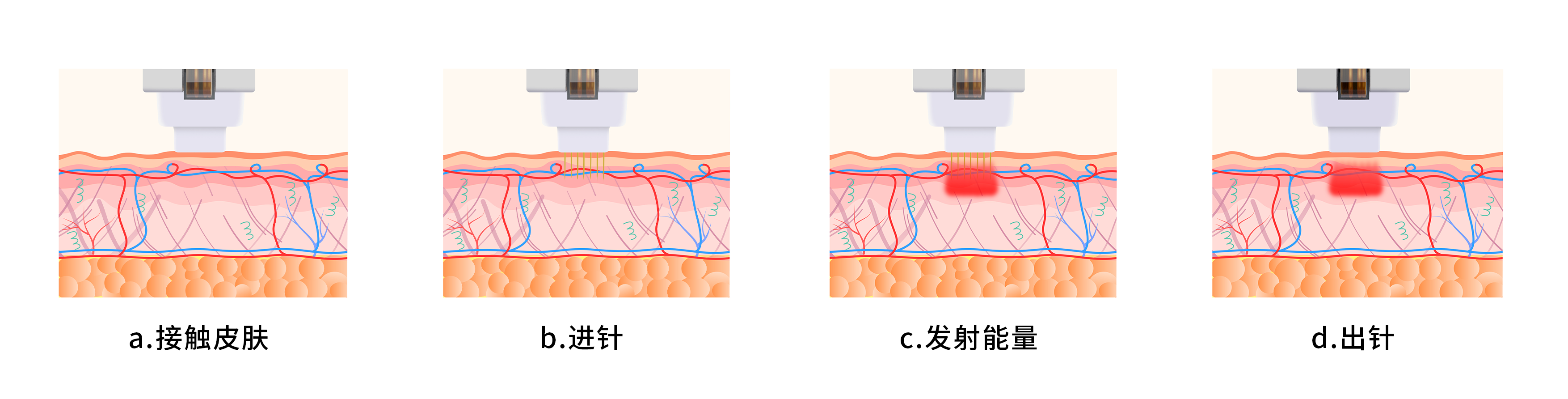未标题-1.png 未标题-1.png
